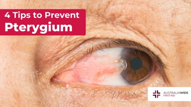 Prevent pterygium article header – First Aid Course Croydon Prevent pterygium article header – First Aid Article in Croydon